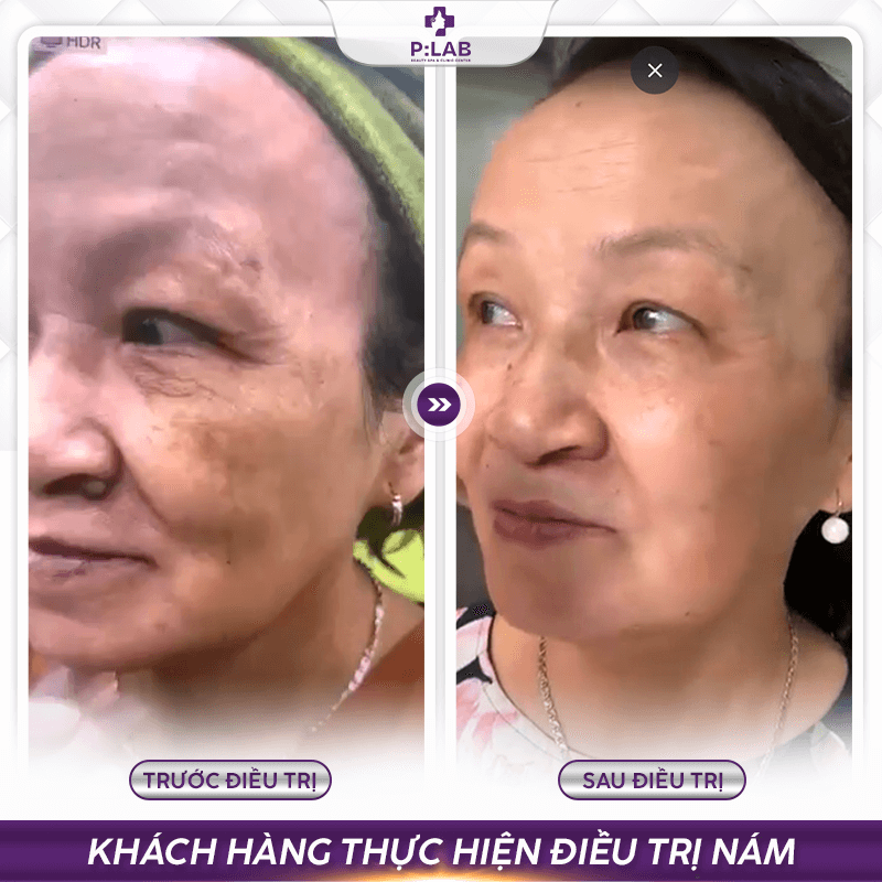 Plab-website (feedback) KH15