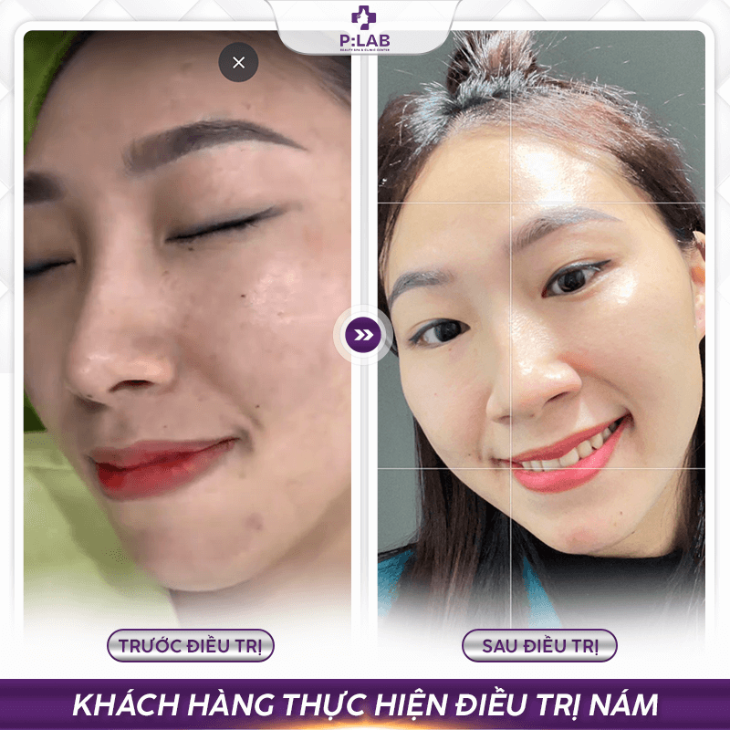 Plab-website (feedback) KH29