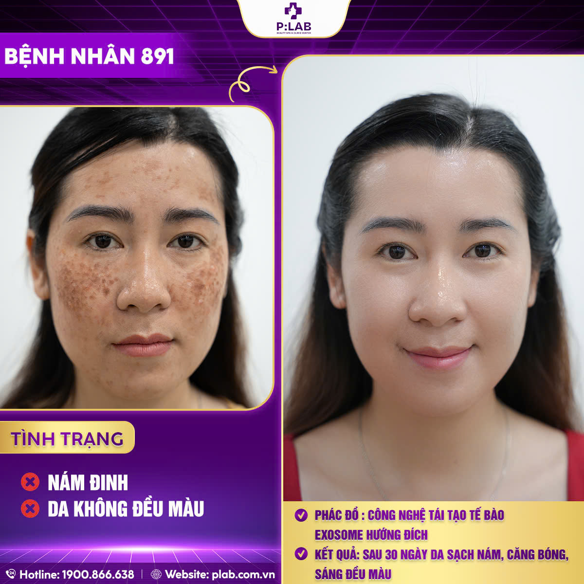 z5701204432291_588e0c5327e3bf02d5752be5fba218c4