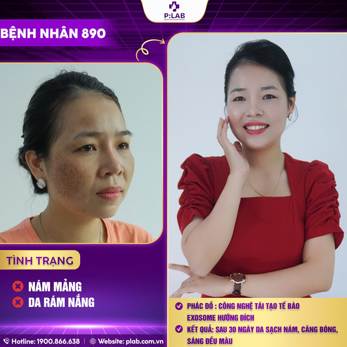 z5701204432294_fe598dfa19dbd59de7b8fc524e520132