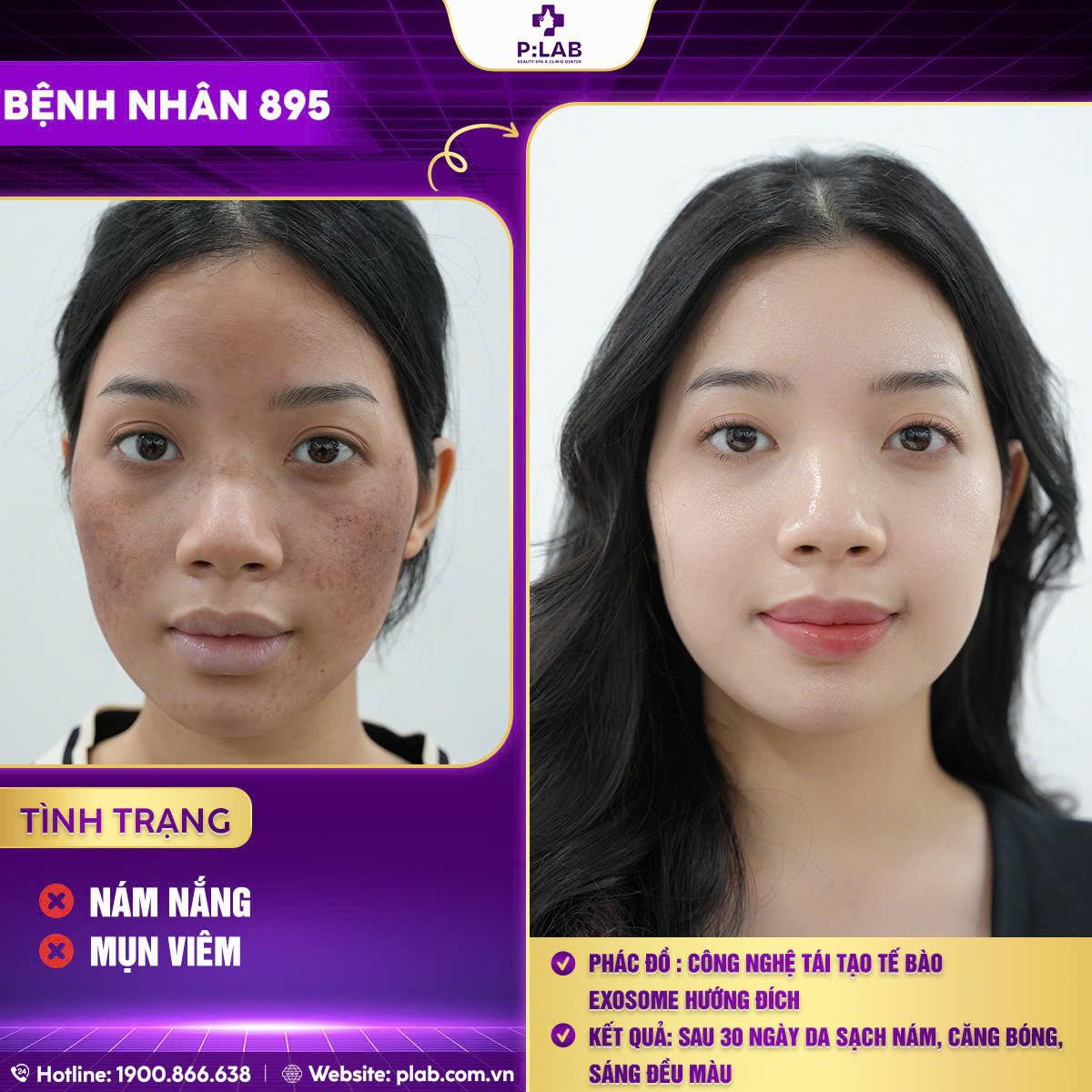 z5701204503044_a7abbb7bca94ac425412ce1b2456701a