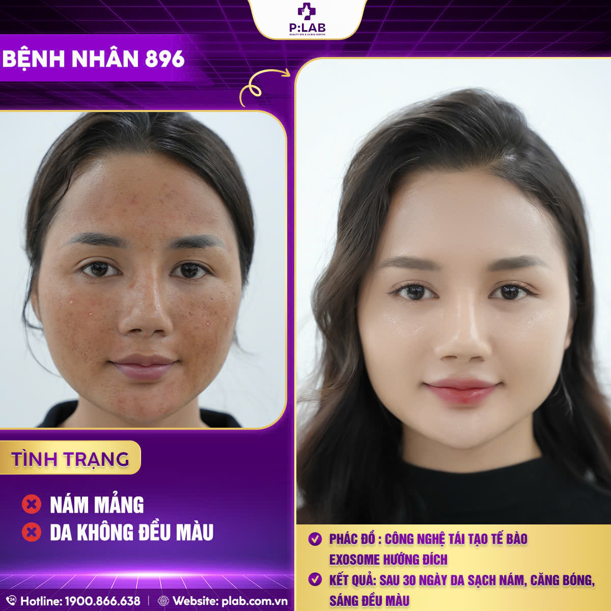 z5701204503045_8e828eebe5c38a6a63a0928f30268196