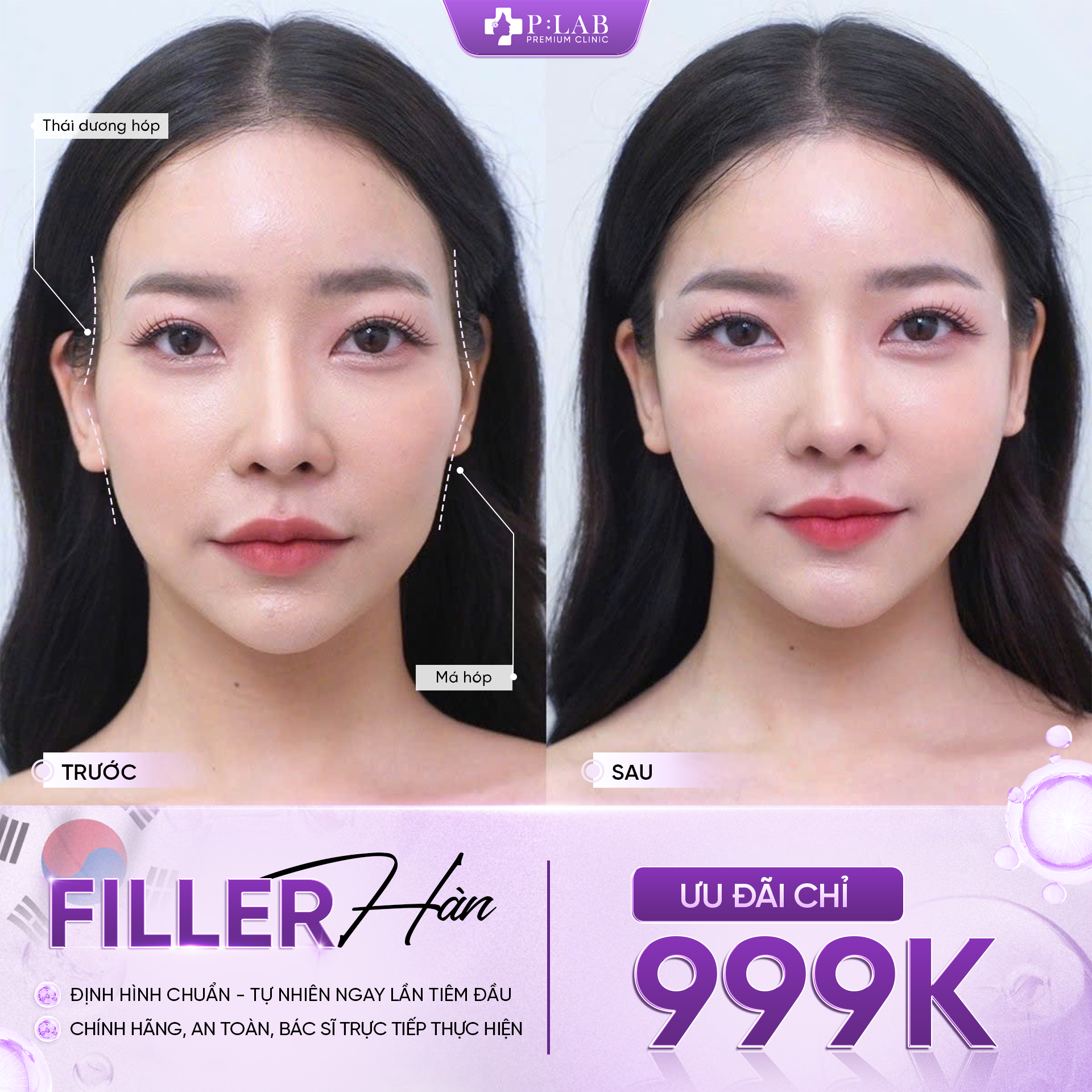 Ảnh 1