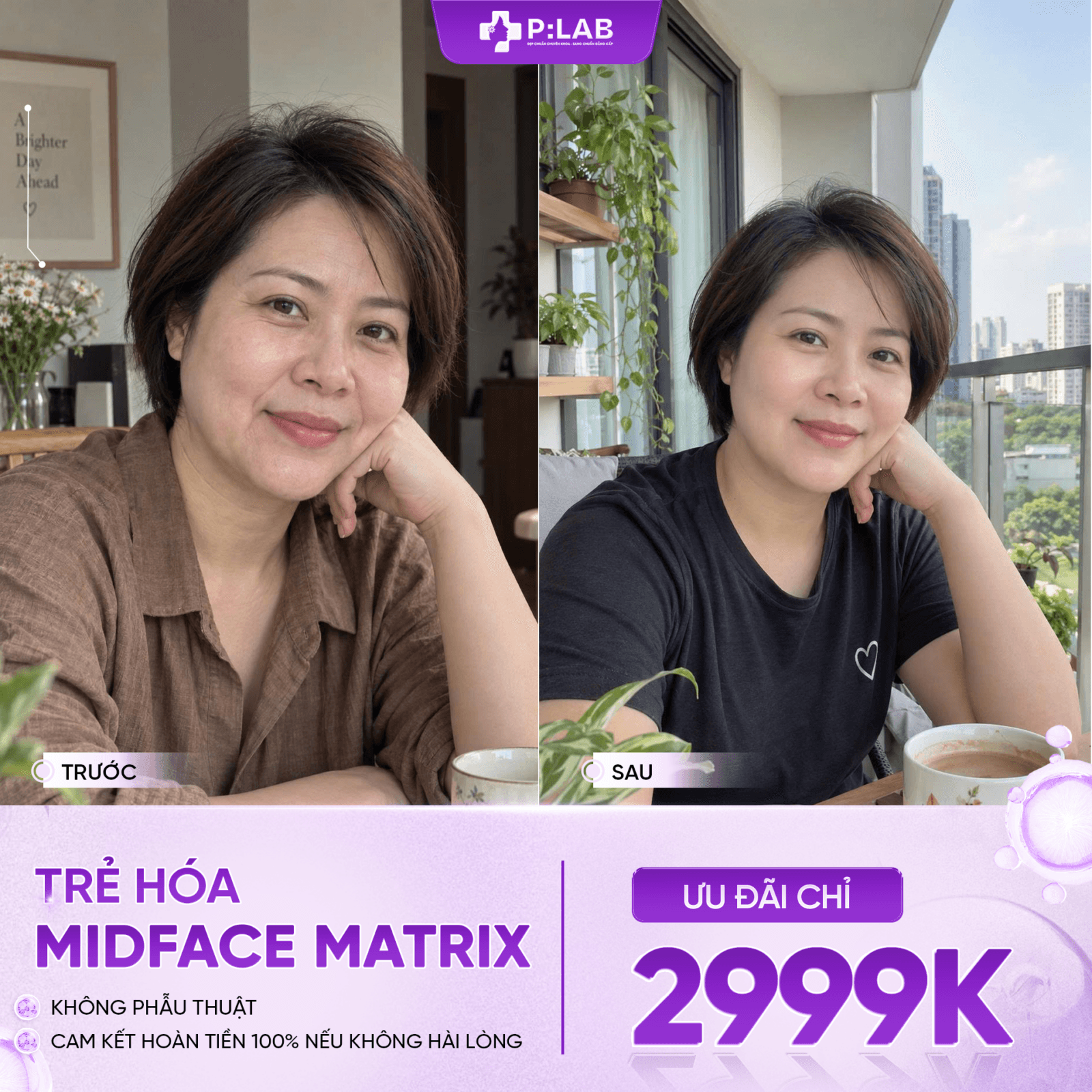 Bảng vẽ 1