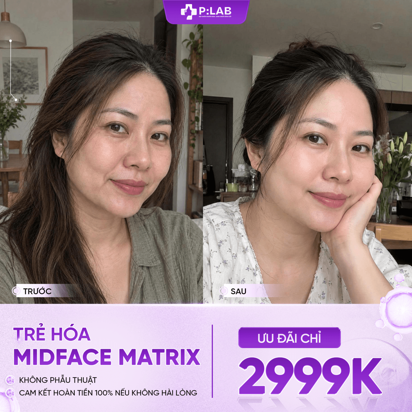 Bảng vẽ 2