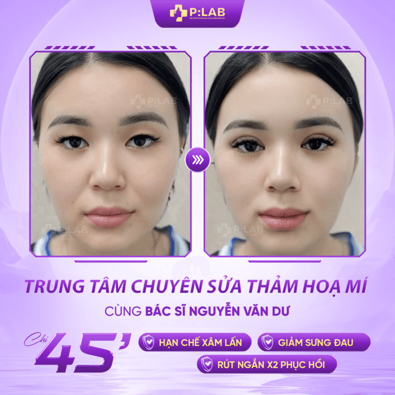 mí 2