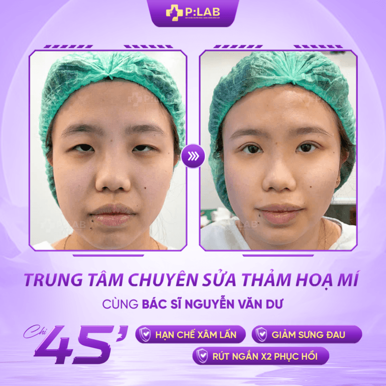 mí 3